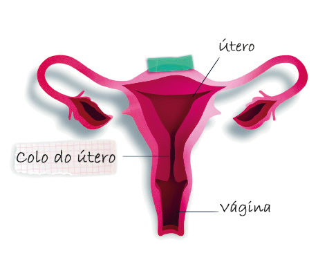 Ilustração: útero - colo do útero - vagina